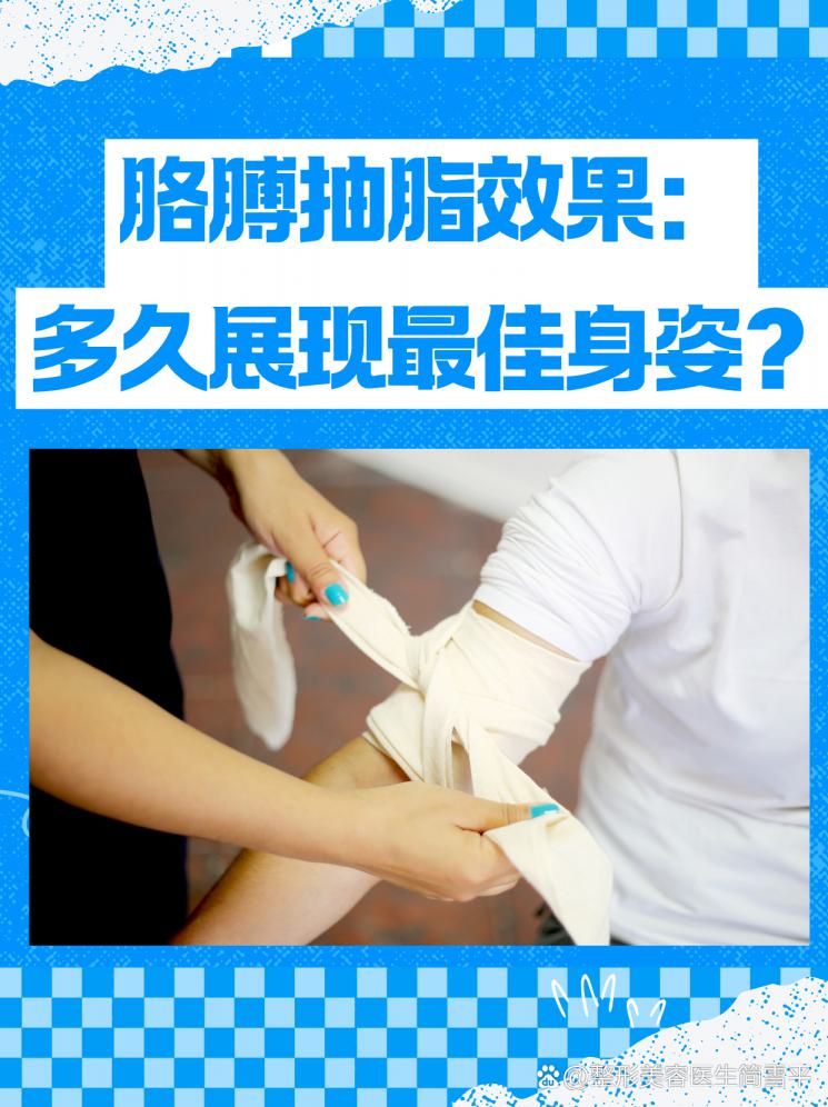 胳膊抽脂效果：多久展现最佳身姿？