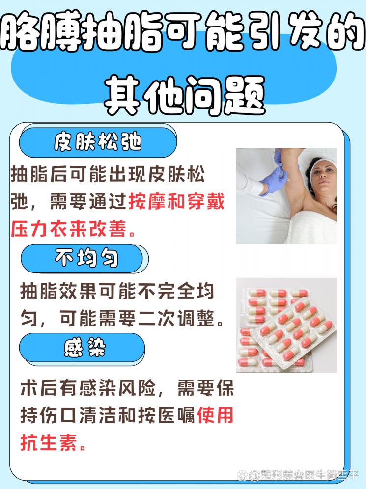 胳膊抽脂效果：多久展现最佳身姿？