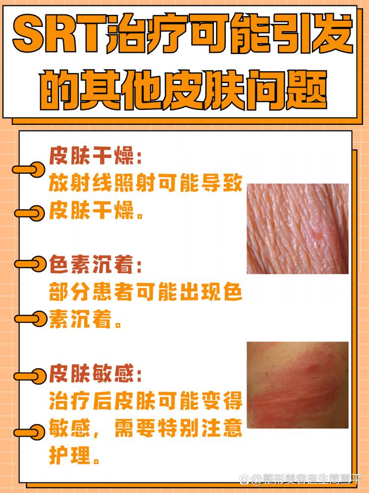 揭秘SRT疤痕治疗：次数与效果全解析