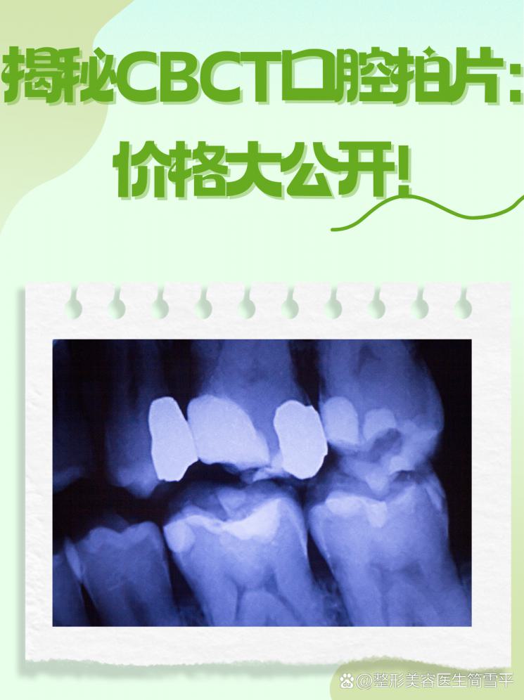 揭秘CBCT口腔拍片：价格大公开！