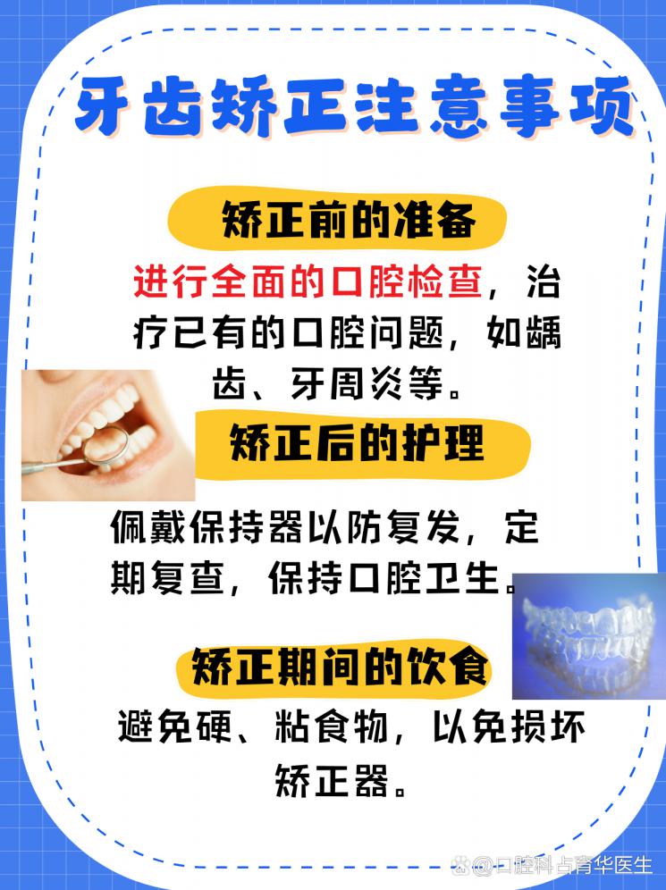 地包天矫正攻略：如何选择合适的矫正方法？
