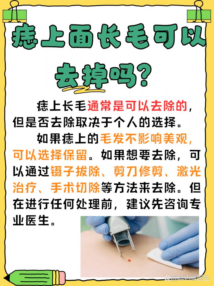 痣上毛发去留大揭秘！能不能去除？