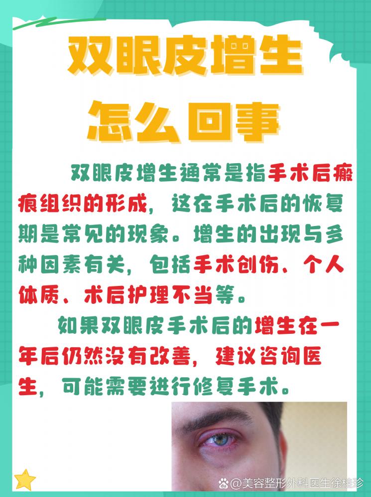 双眼皮手术后增生？别慌，这里有答案！