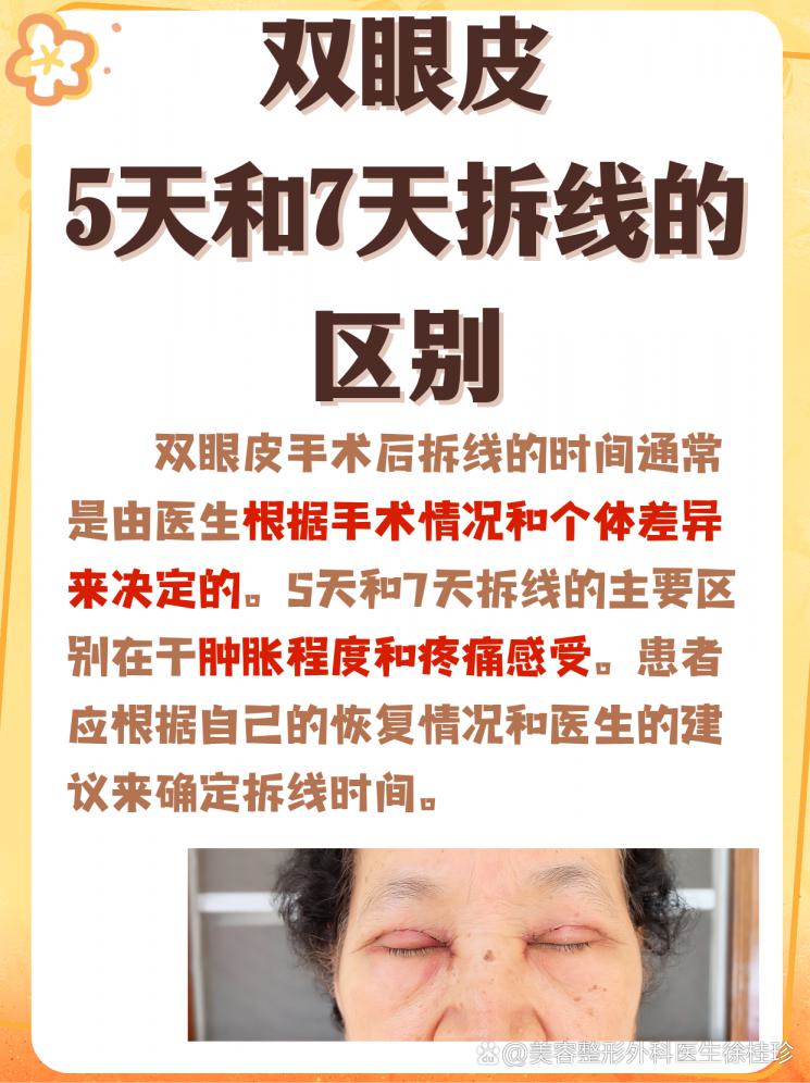 双眼皮拆线时间大PK，5天VS7天，你pick谁？