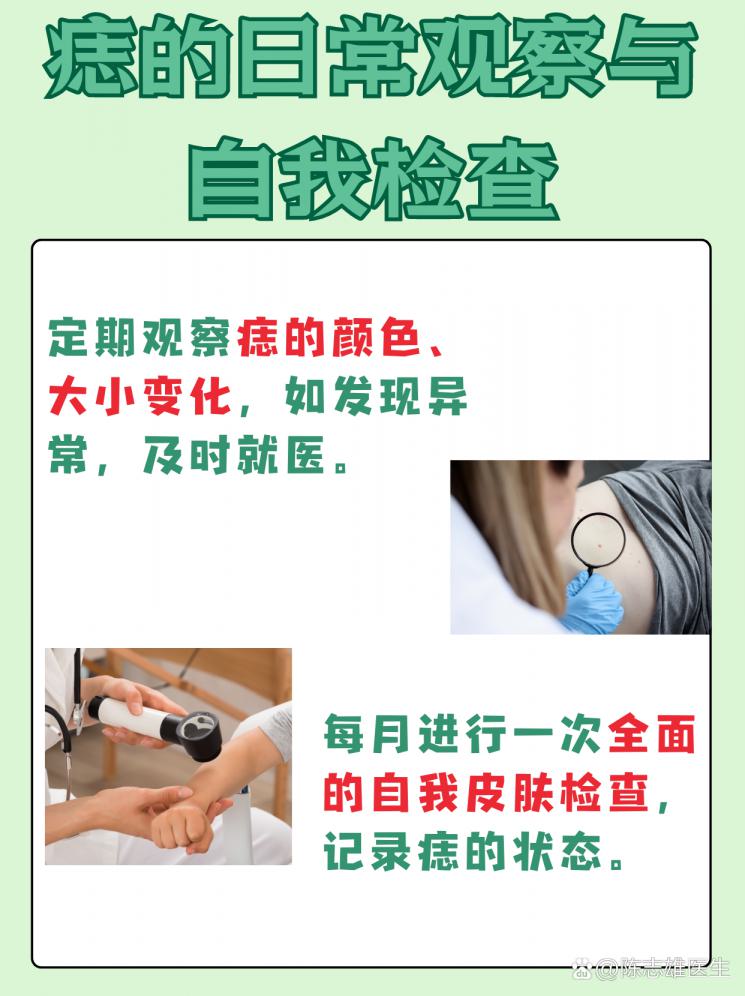 痣治疗：手术VS激光，哪个更胜一筹？