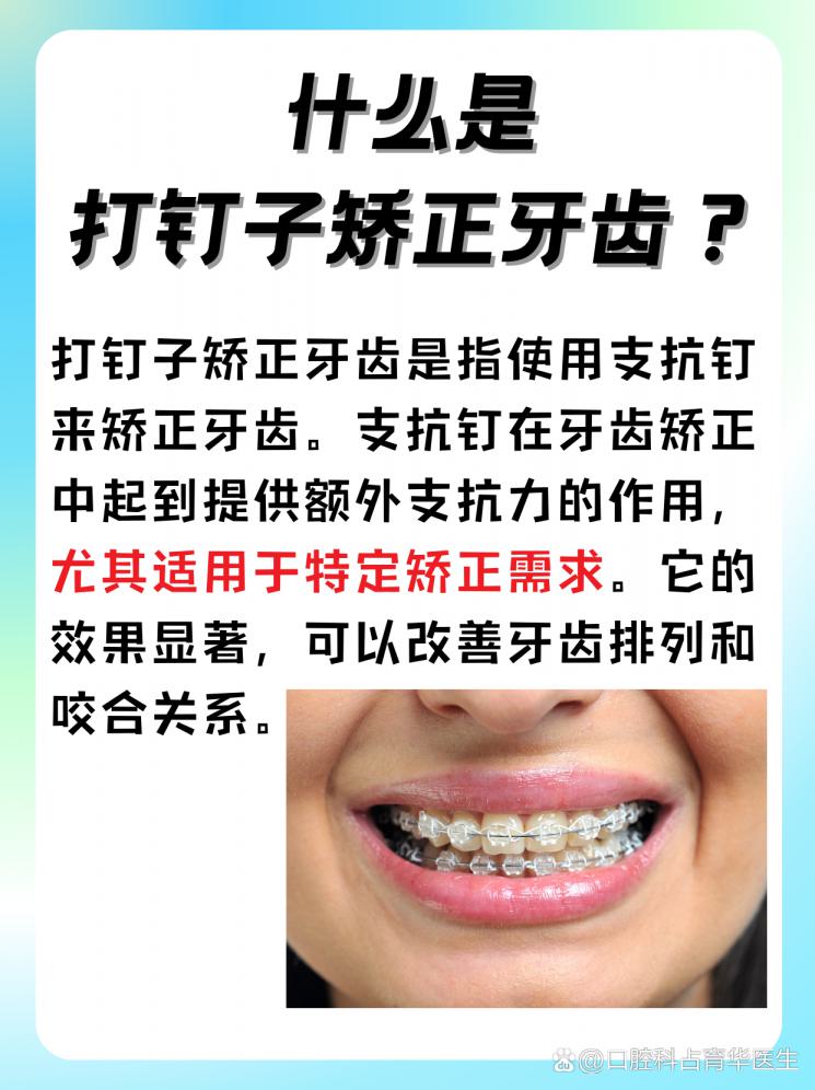 打钉子矫正牙齿？揭秘支抗钉的作用！