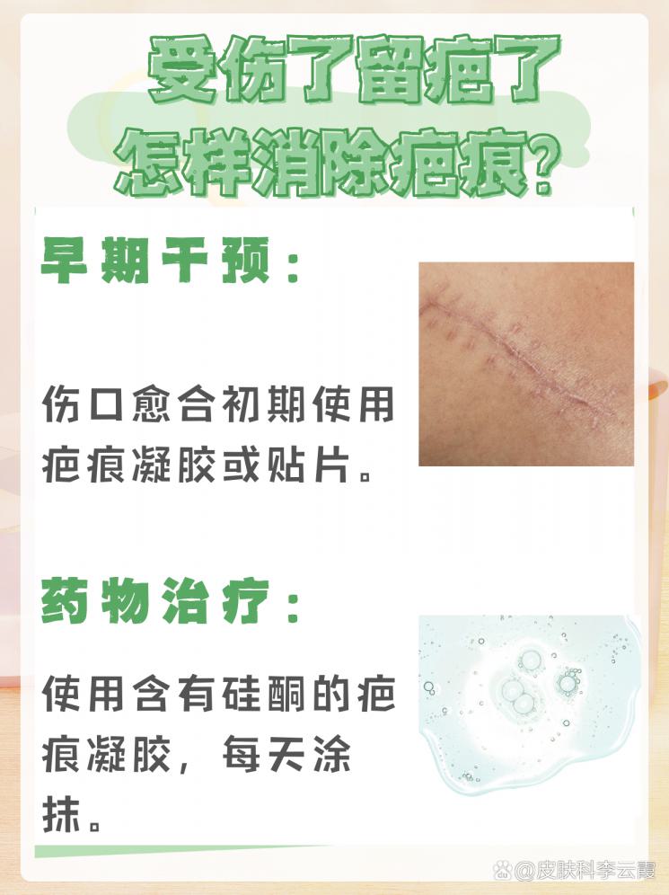 疤痕修复全攻略：从治疗到日常护理