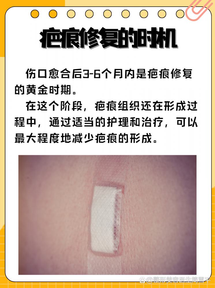 【疤痕修复】孩子缝针后，最佳修复时机