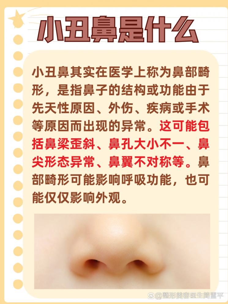 小丑鼻？别怕，这里有秘方！