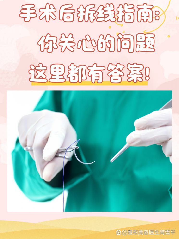 手术后拆线指南：你关心的问题这里都有答案！