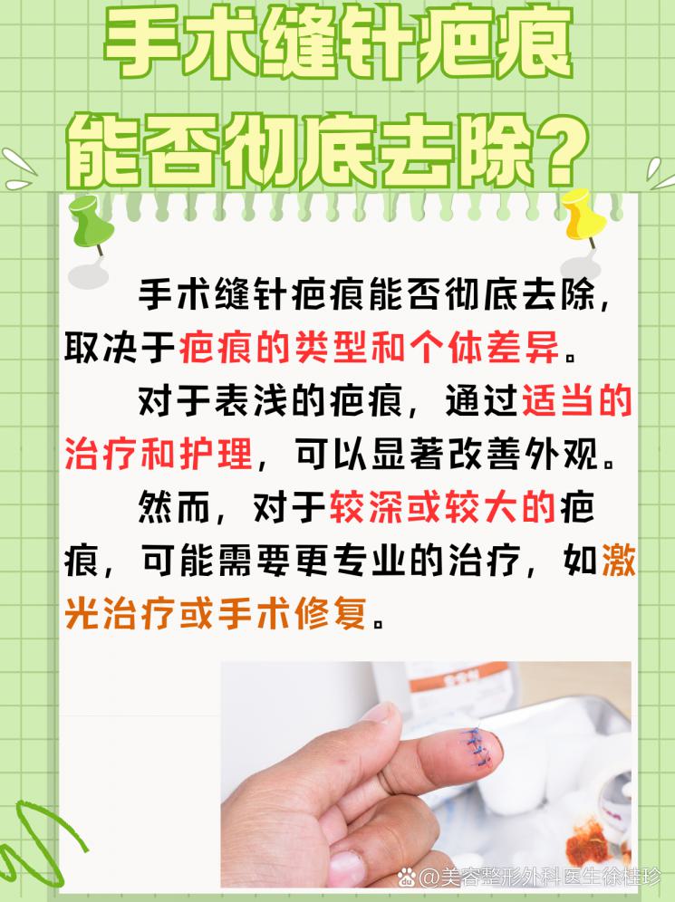 疤痕无痕：手术缝针疤痕的真相与治疗