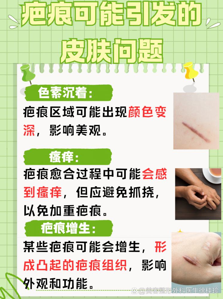 疤痕无痕：手术缝针疤痕的真相与治疗