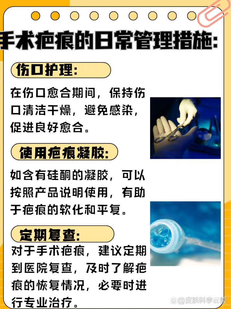 手术疤痕消除：可能与方法