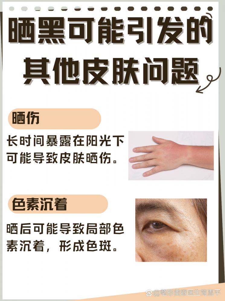 晒黑不用愁，快速白回来的秘诀