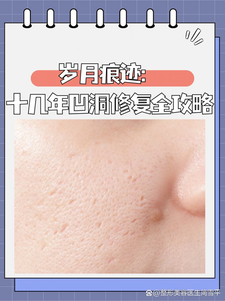 岁月痕迹：十几年凹洞修复全攻略