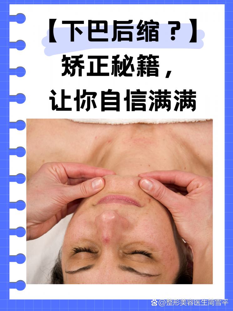 【下巴后缩？】矫正秘籍，让你自信满满