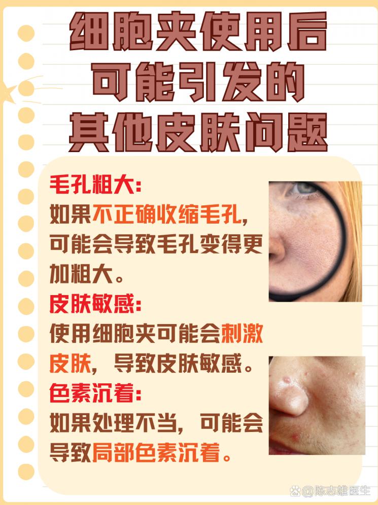 细胞夹去黑头后：毛孔收缩秘诀大公开