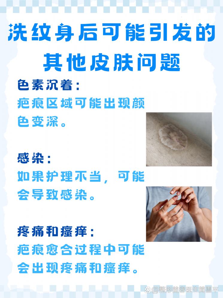 洗纹身疤痕修复：增生凸起全攻略