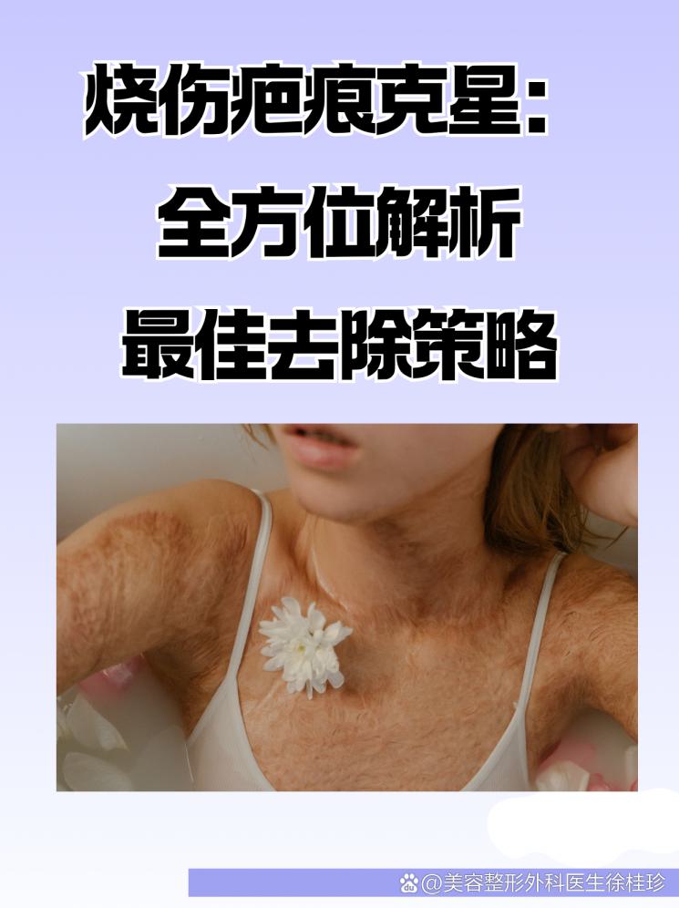 烧伤疤痕克星：全方位解析最佳去除策略