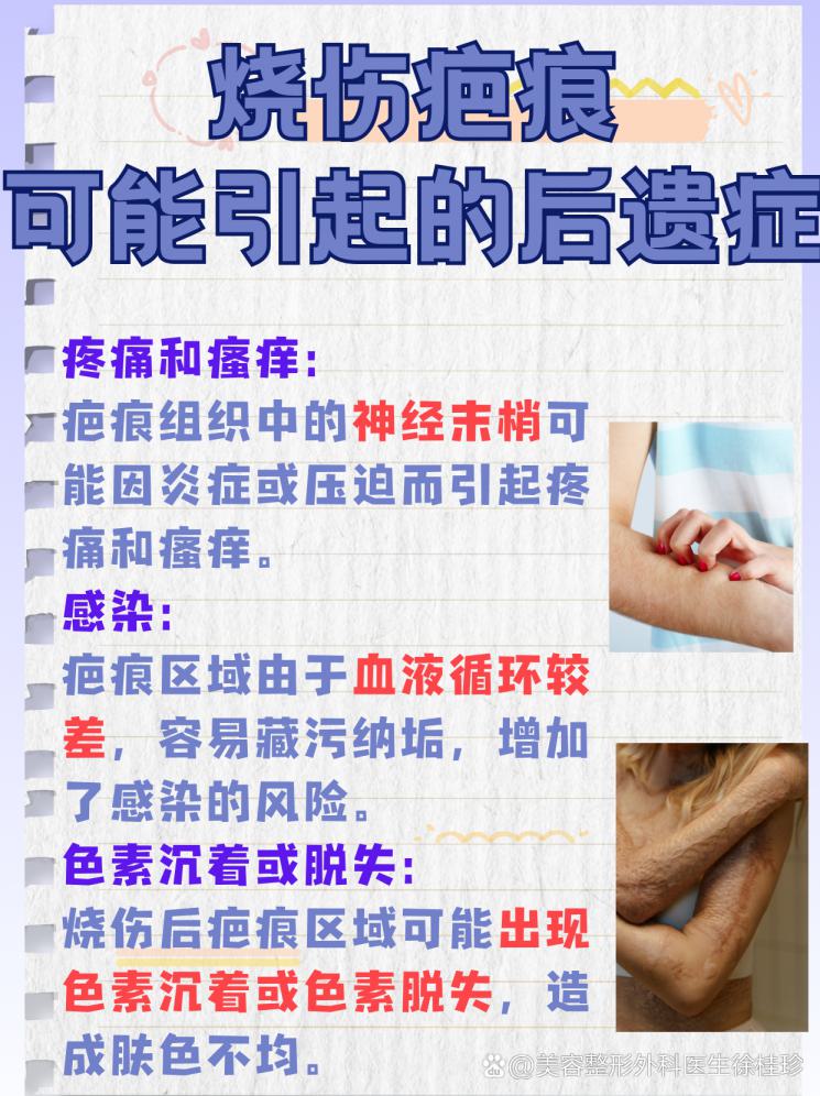 烧伤疤痕克星：全方位解析最佳去除策略