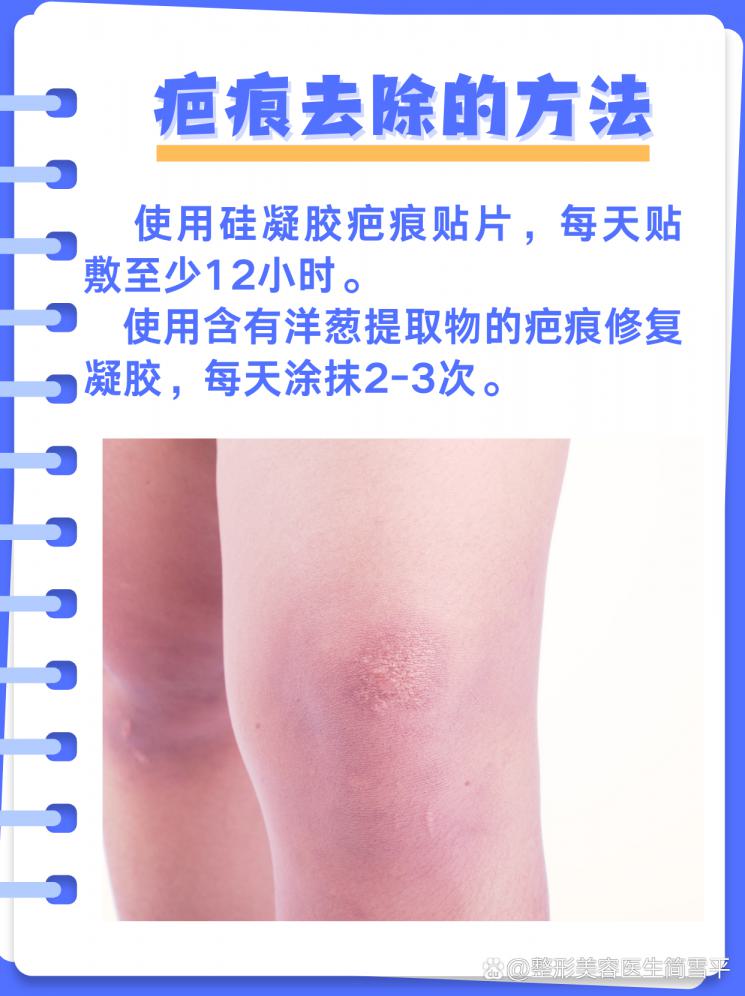 膝盖疤痕修复全攻略：去除疤痕的秘诀