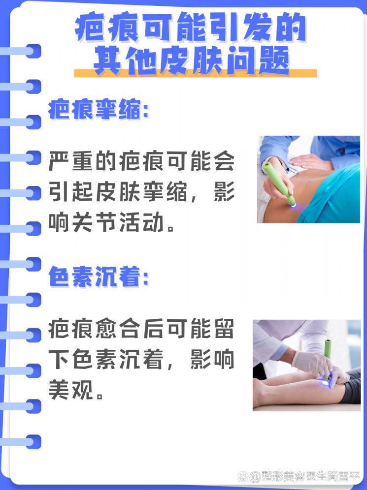 膝盖疤痕修复全攻略：去除疤痕的秘诀