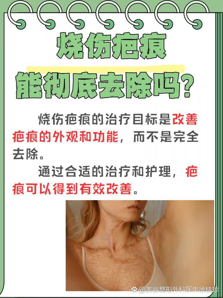 烧伤疤痕：彻底去除还是有效改善？