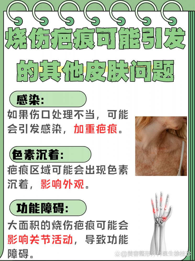 烧伤疤痕：彻底去除还是有效改善？