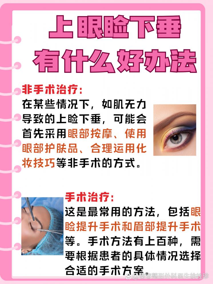 上眼睑下垂？别担心，这里有妙招