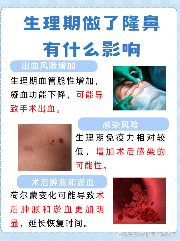 生理期隆鼻：风险与恢复指南