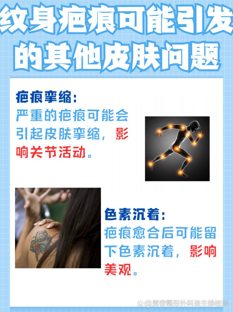 揭秘纹身疤痕：如何有效去除增生性疤痕