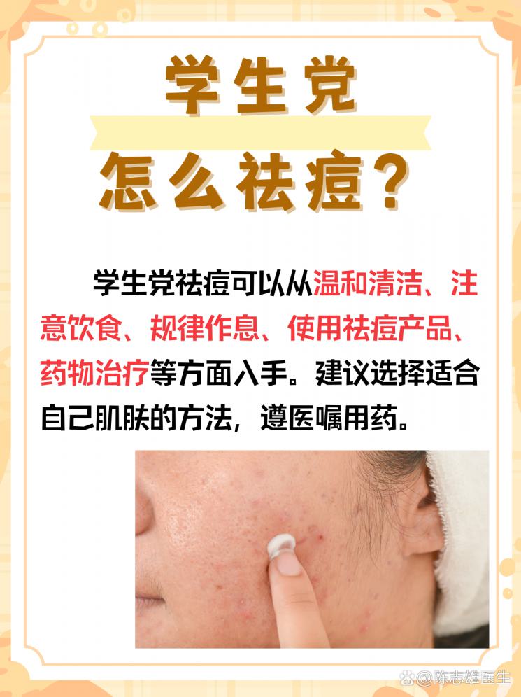 学生党战痘秘籍！祛痘妙招大公开！
