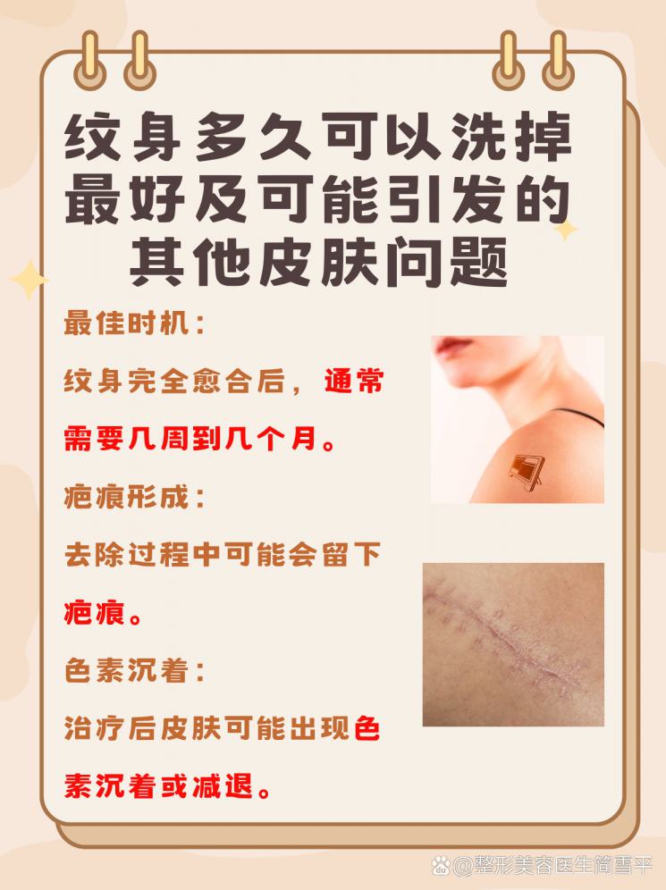 纹身后悔了？最佳时机与方法揭秘