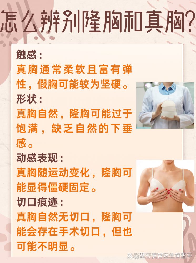 如何辨别隆胸与真胸？揭秘辨别技巧！