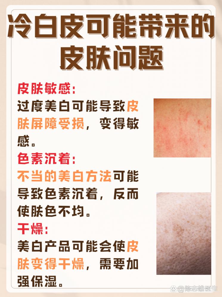 冷白皮养成秘籍：美白新策略大公开