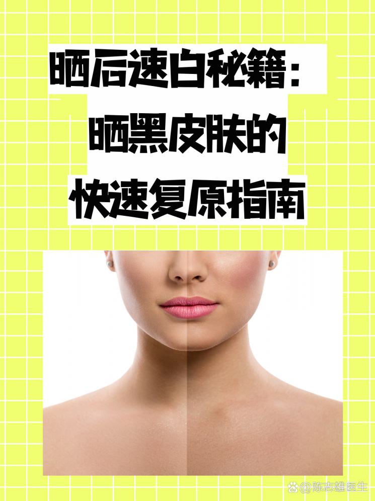 晒后速白秘籍：晒黑皮肤的快速复原指南