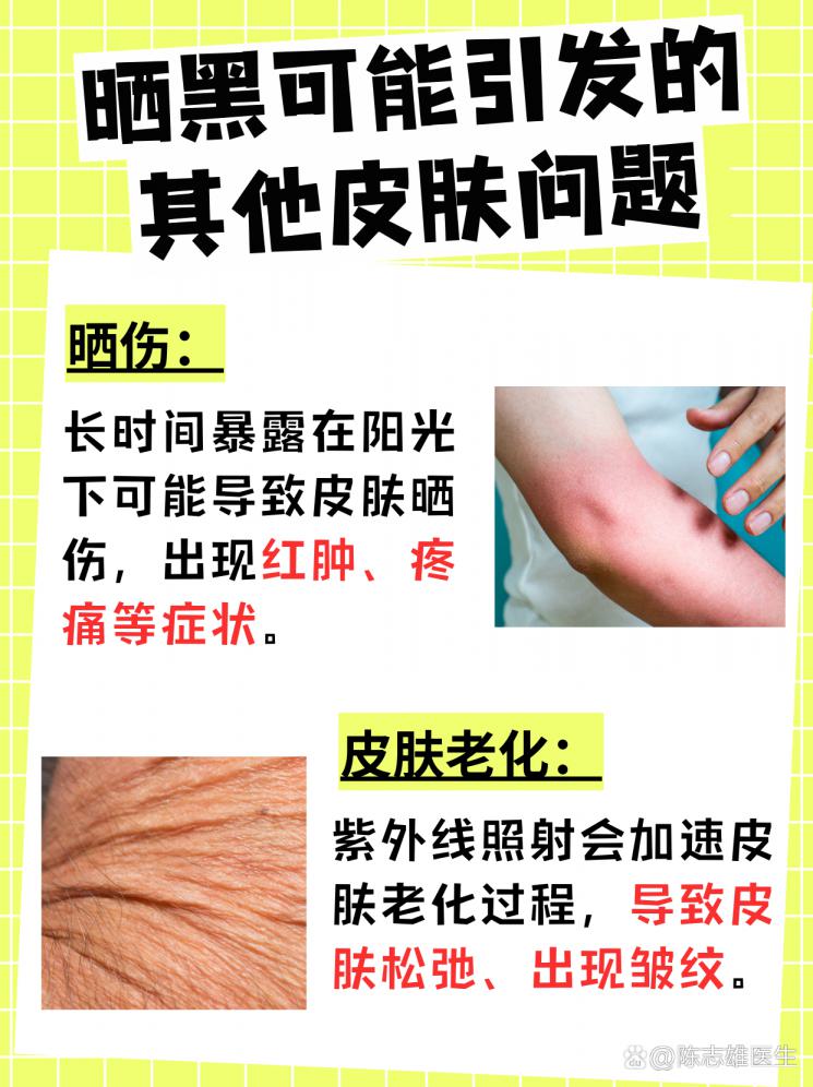 晒后速白秘籍：晒黑皮肤的快速复原指南