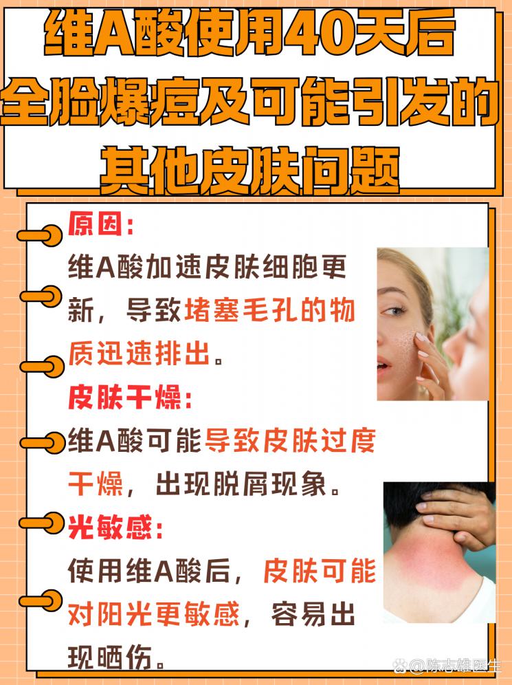 维A酸治疗后爆痘？揭秘皮肤反应真相