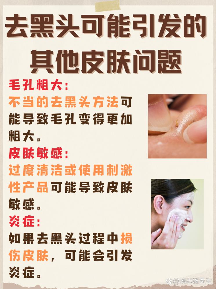 居家去黑头攻略：简单步骤还原净透肌肤