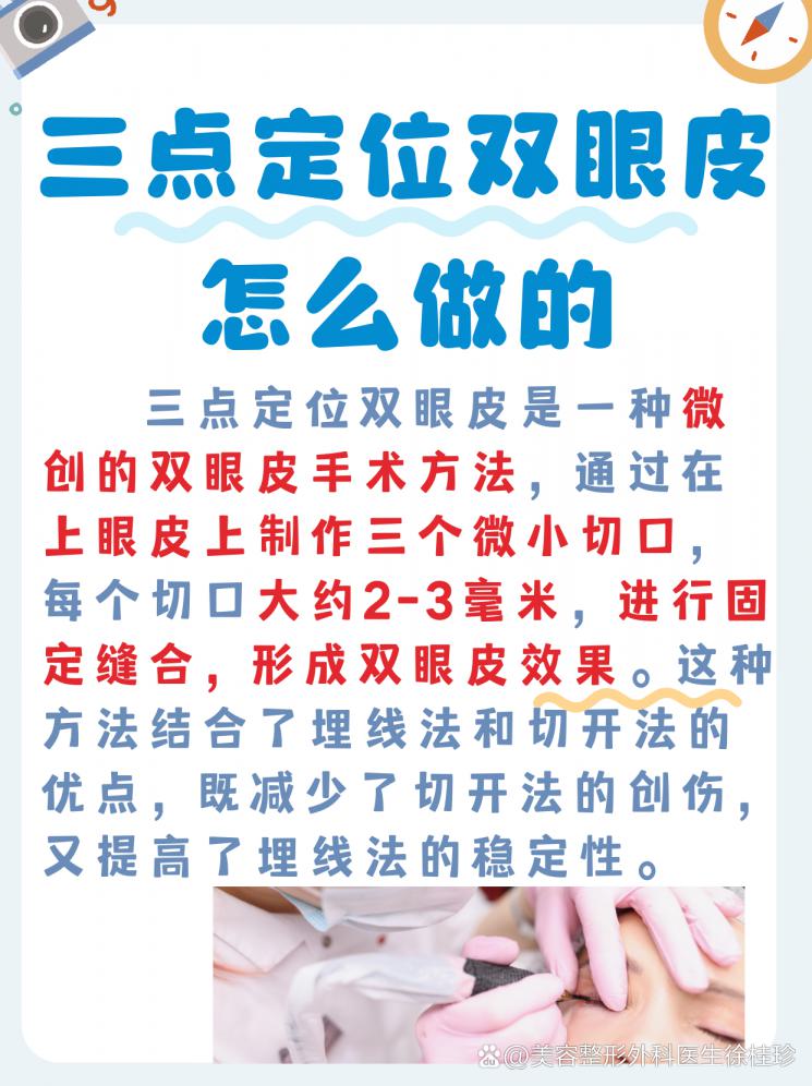 三点定位双眼皮，让你的眼睛会说话！