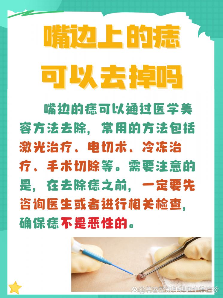 痣說再見！ 嘴邊痣去除全攻略！