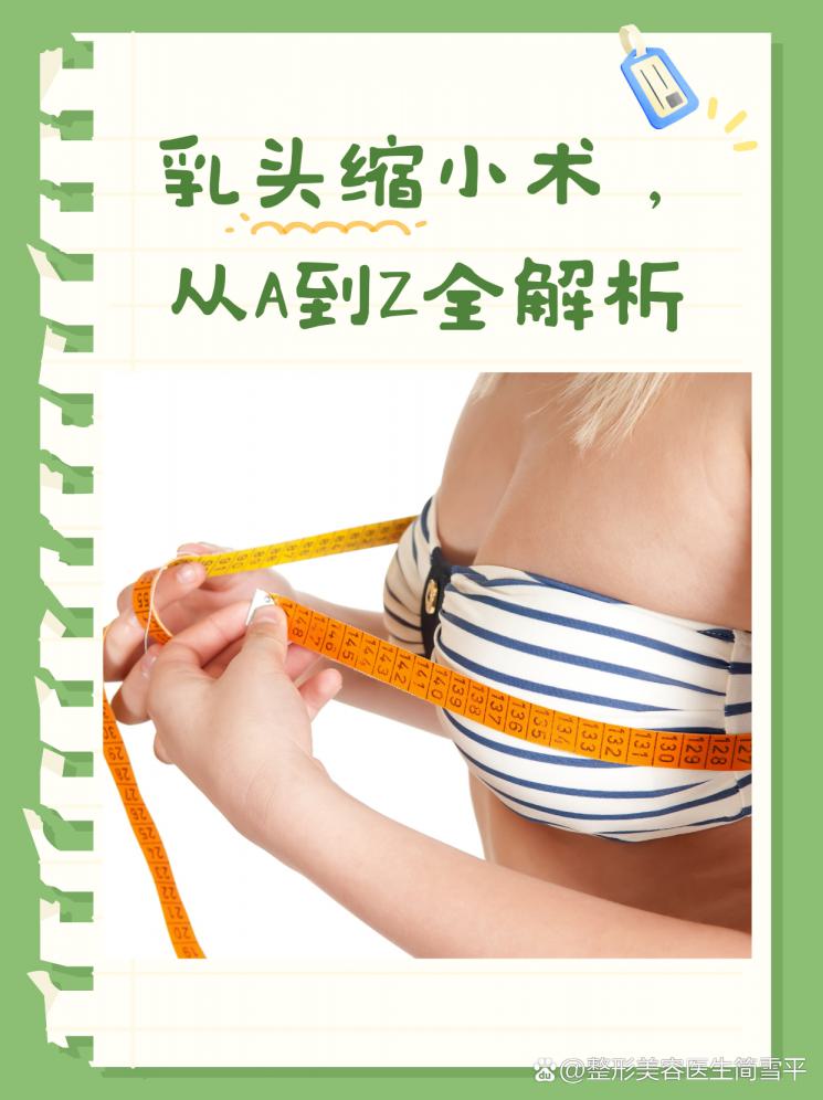 乳头缩小术，从A到Z全解析