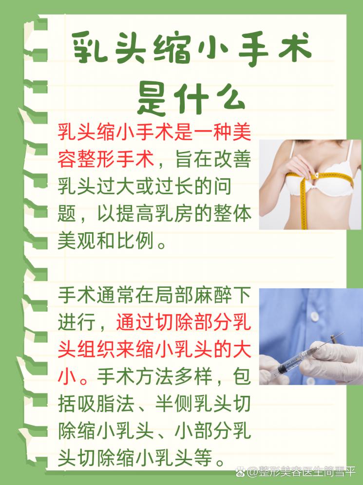 乳头缩小术，从A到Z全解析