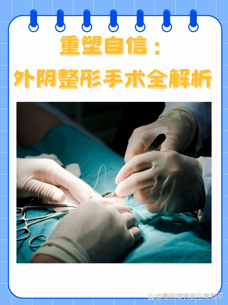 重塑自信：外阴整形手术全解析
