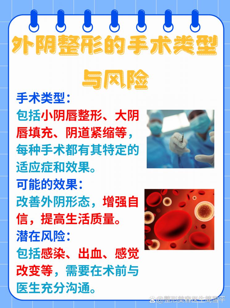 重塑自信：外阴整形手术全解析