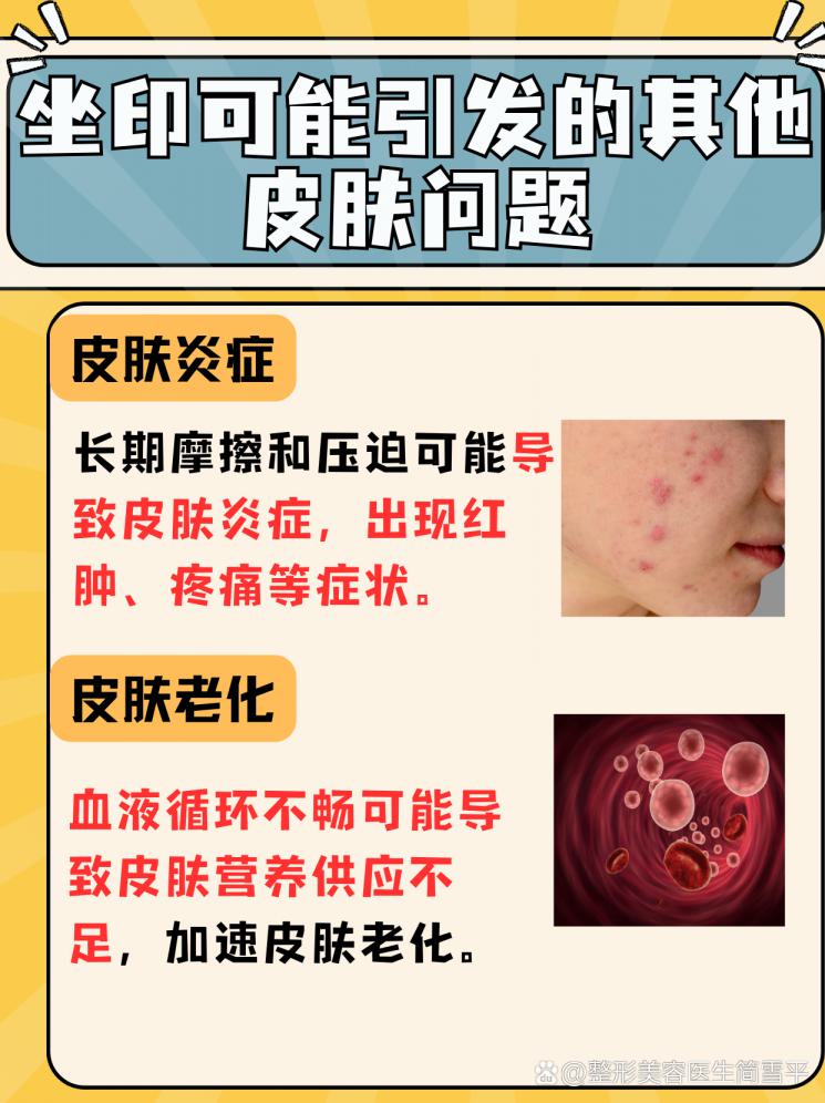 告別臀部黑印：揭秘去除坐印的有效方法