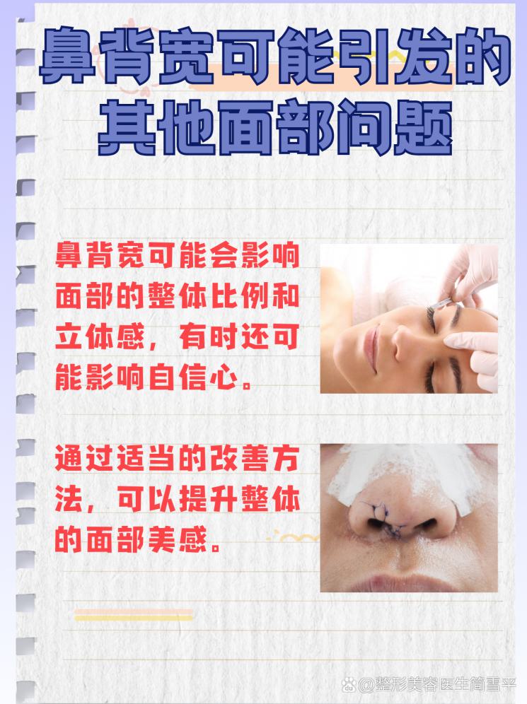 鼻背宽不再是问题：改善秘诀大公开