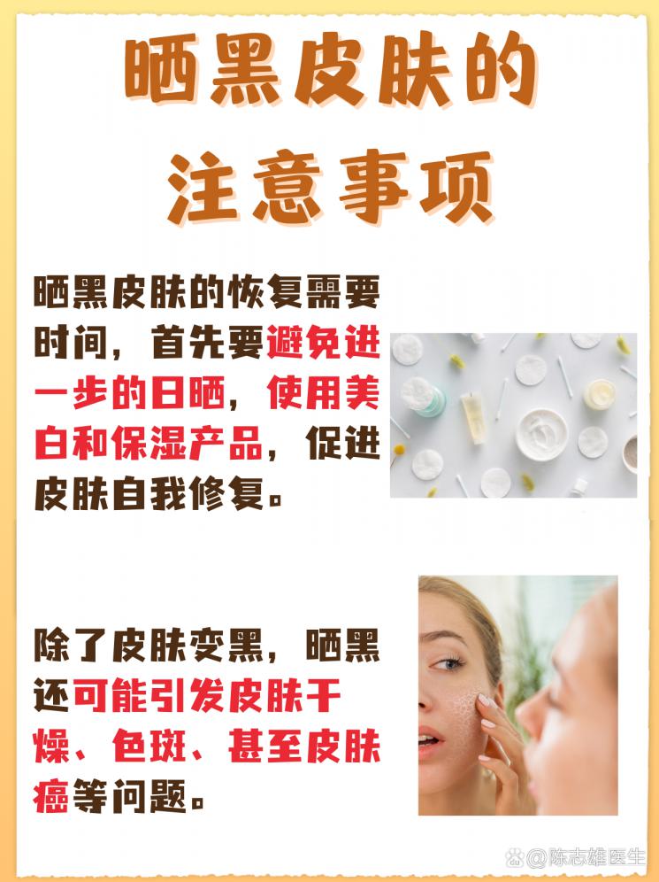 晒后美白攻略：夏日晒黑速救
