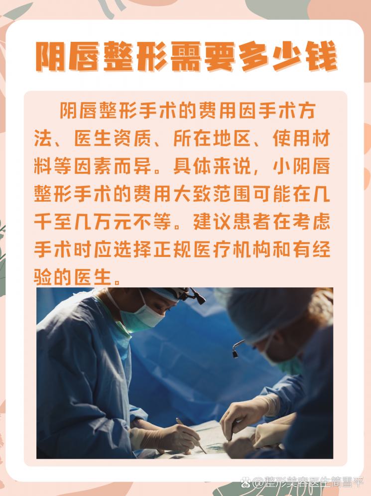 阴唇整形价格大揭秘！你想知道的都在这里！