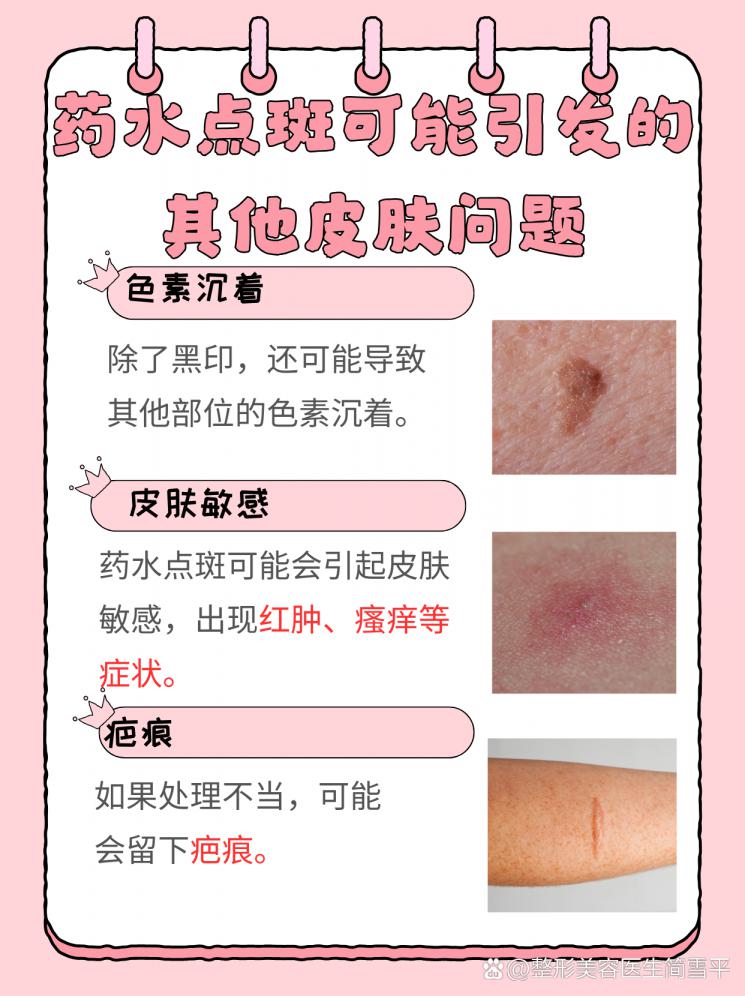 点斑黑印难消？快速修复秘籍来了